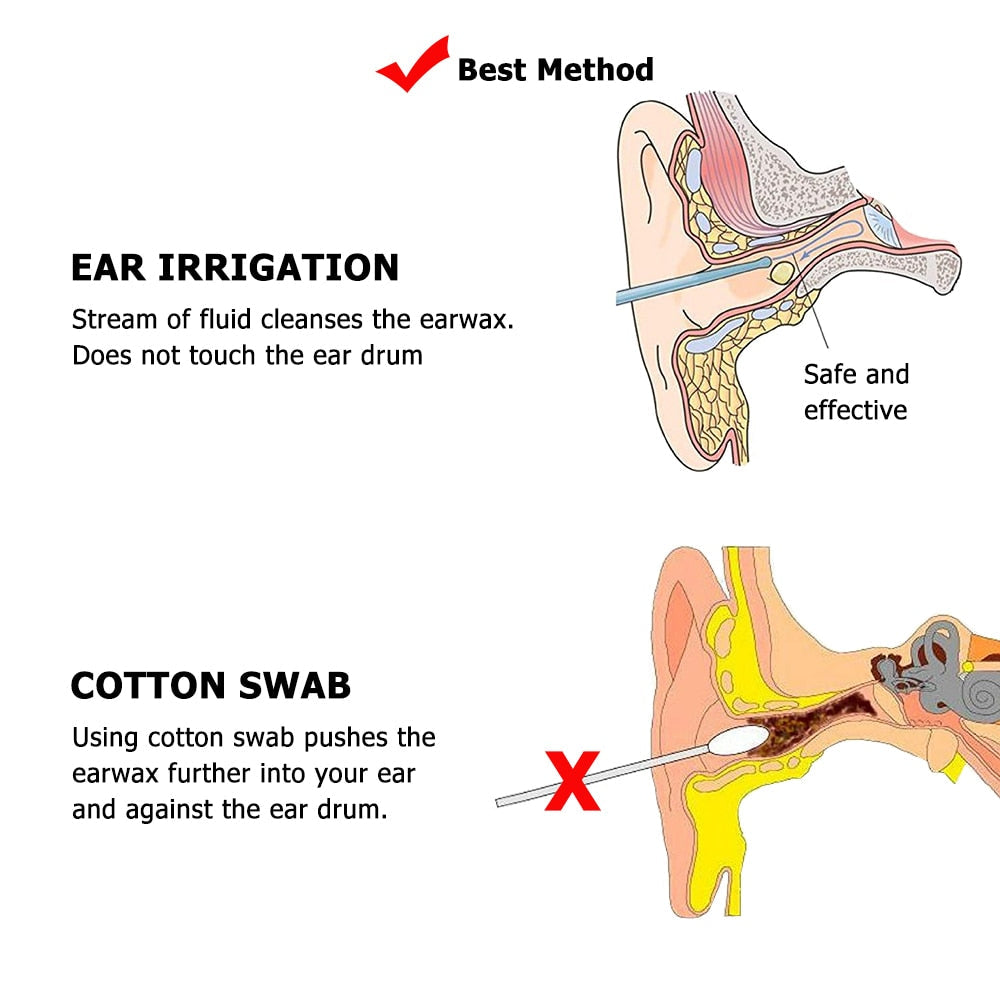 Ear Irrigation Cleaning Kit Ear Wax Removal Kit  removel
